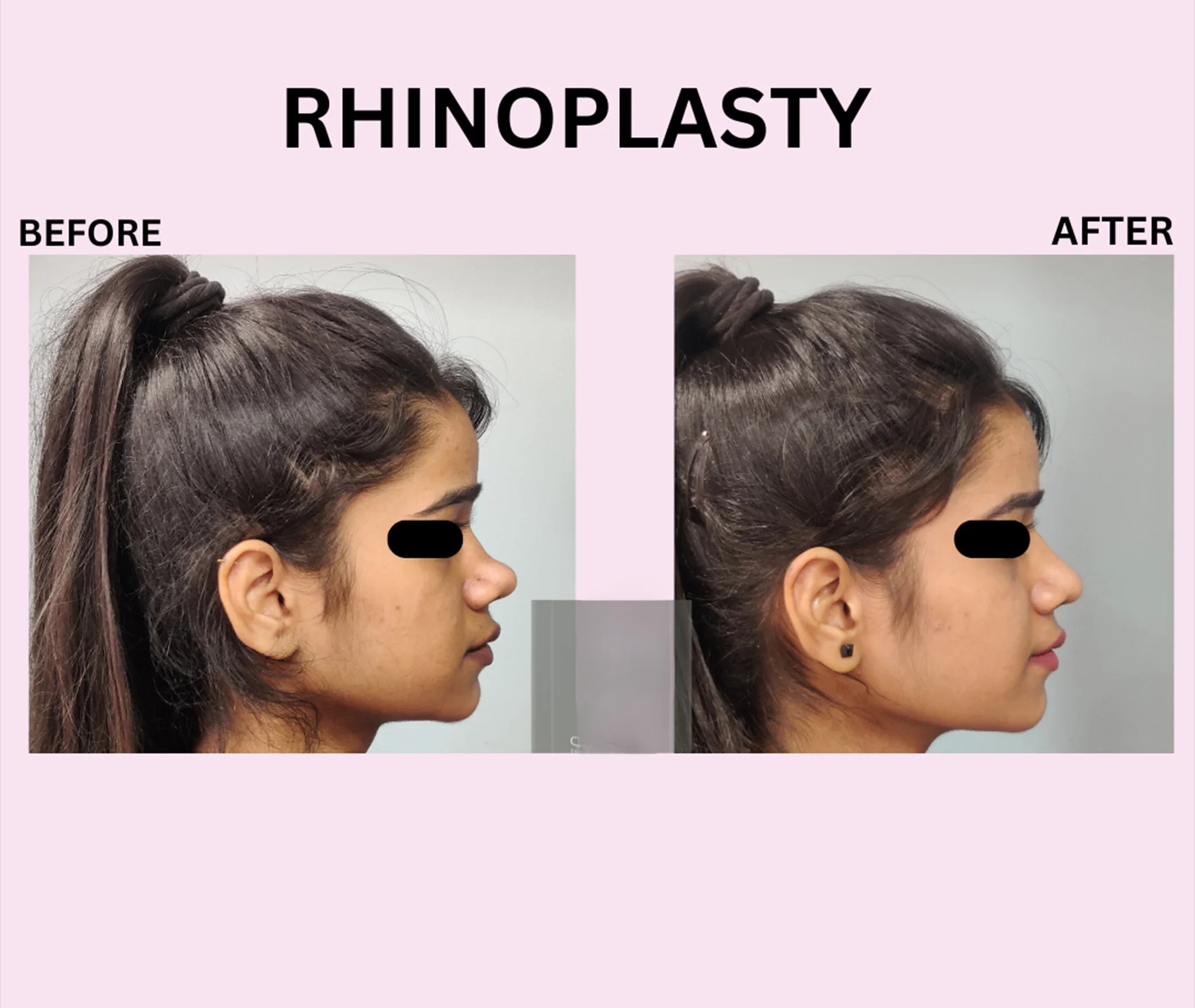 result image
