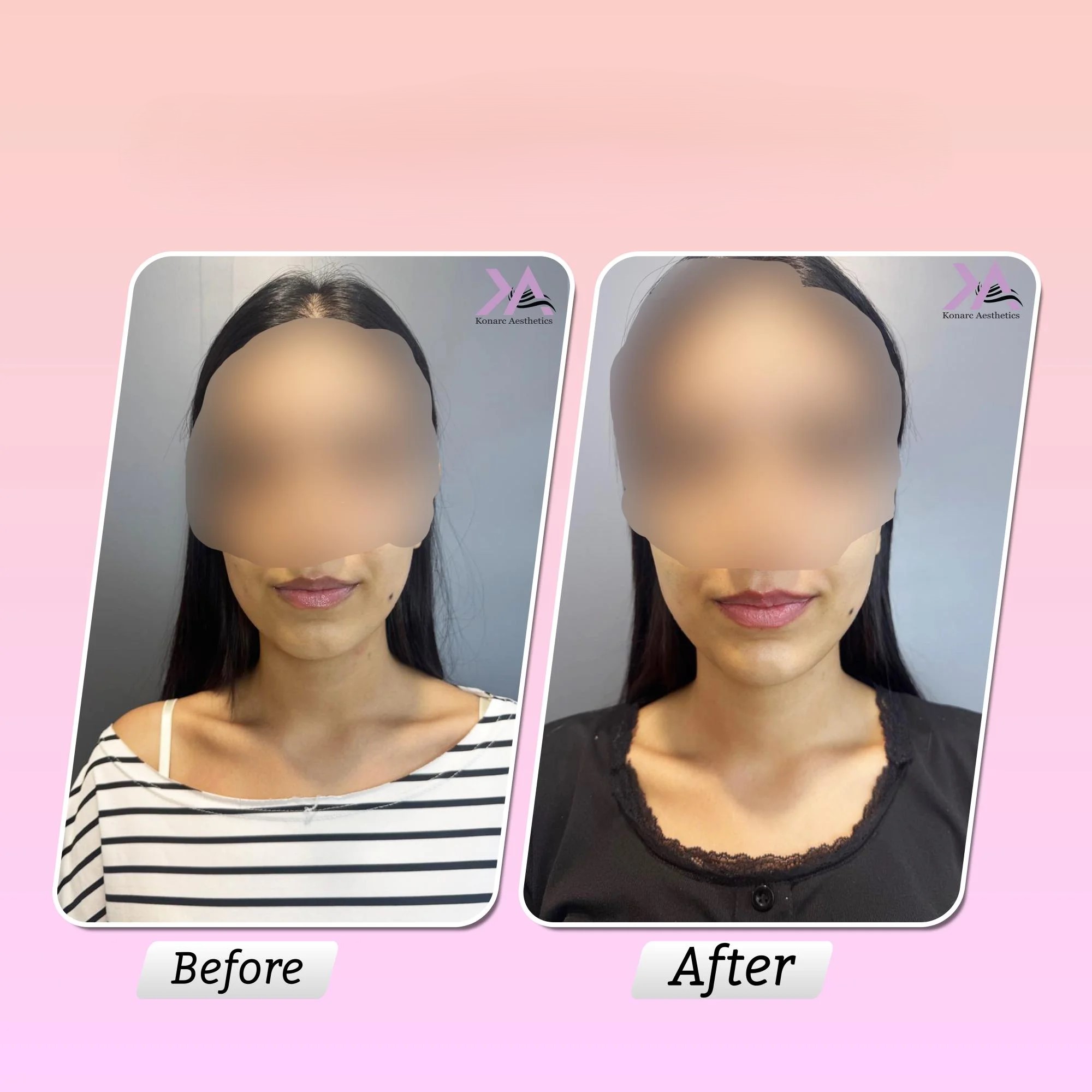 result image