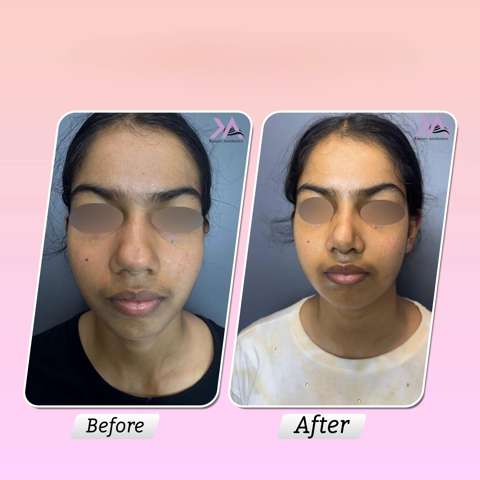 result image