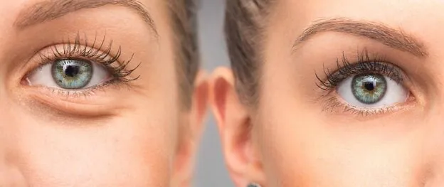 cosmetic Surgery