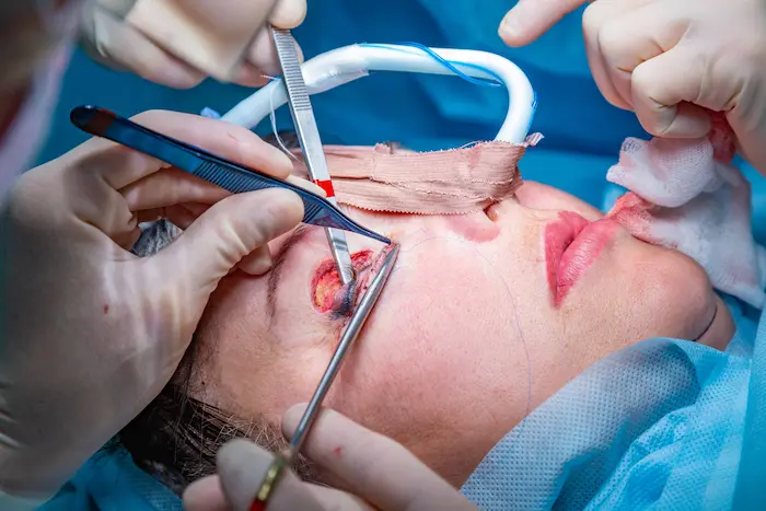 cosmetic Surgery