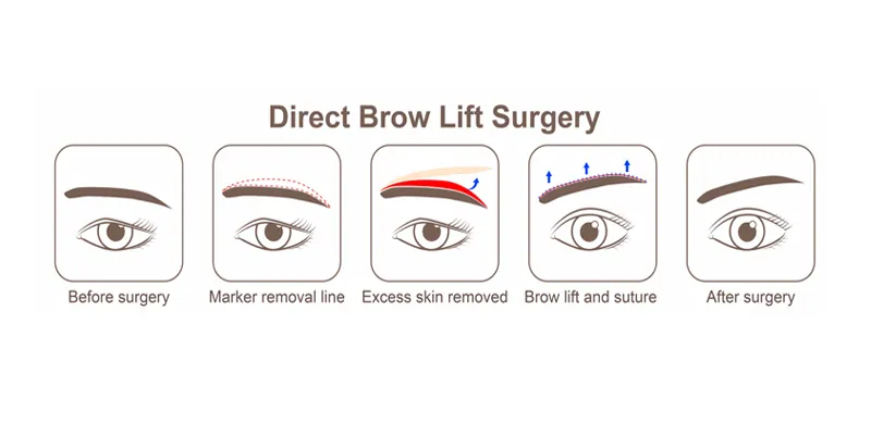 cosmetic Surgery