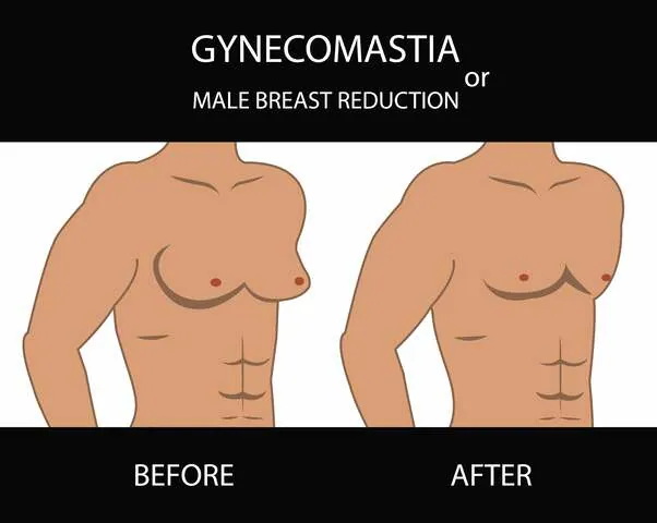 cosmetic Surgery