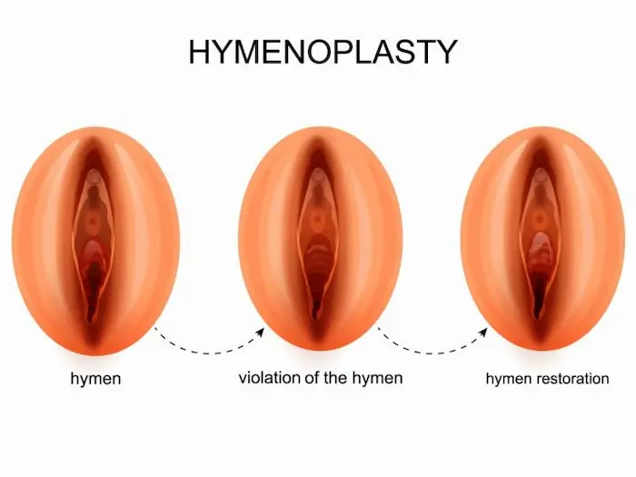 cosmetic Surgery