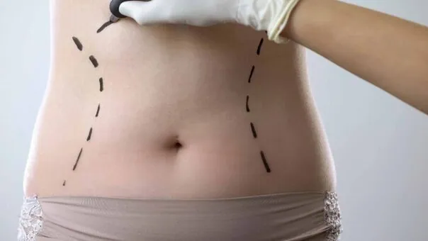 cosmetic Surgery