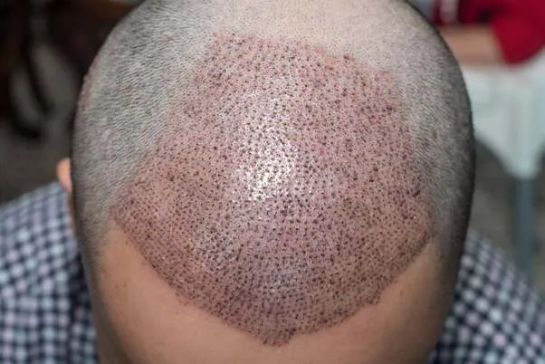 cosmetic Surgery